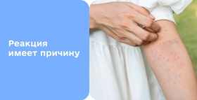 Картинка - Аллергический дерматит: симптомы, диагностика и лечение