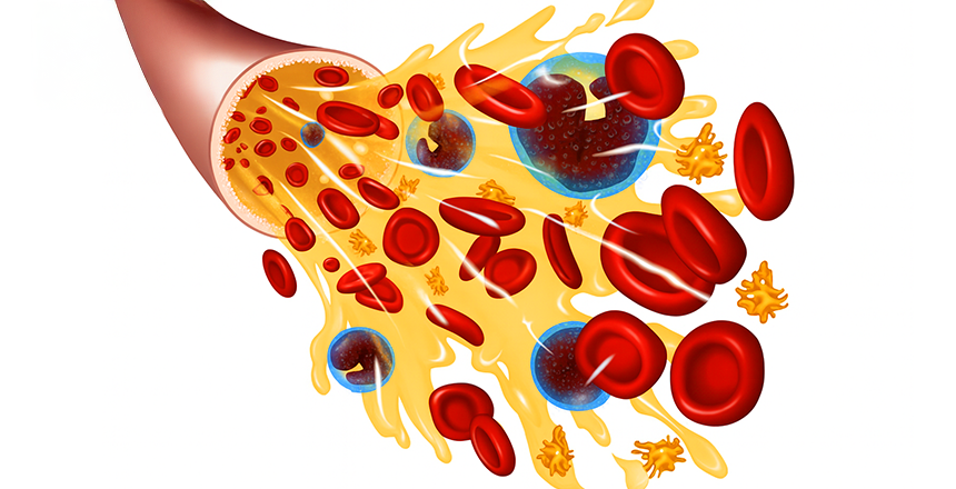 Фото - Кров людини