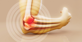 Ревматизм: ознаки, причини та сучасні методи діагностики та лікування
