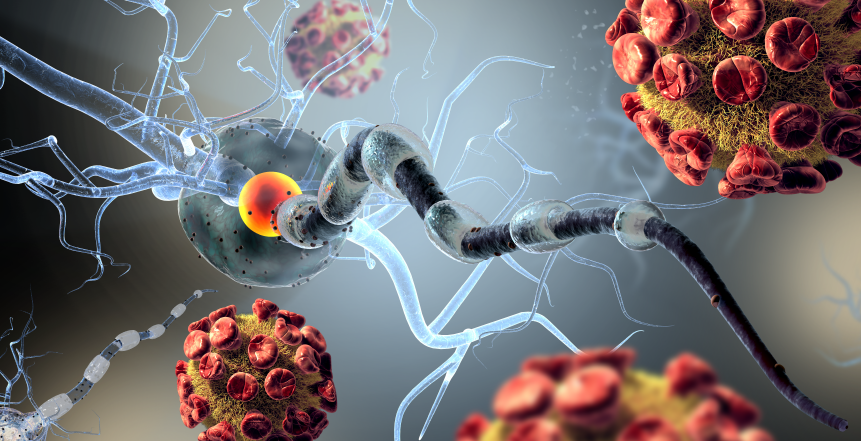 Фото - Вторинні імунодефіцити