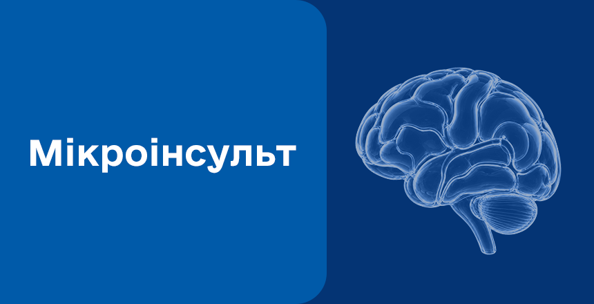 Фото - Мікроінсульт: симптоми, причини та перша допомога