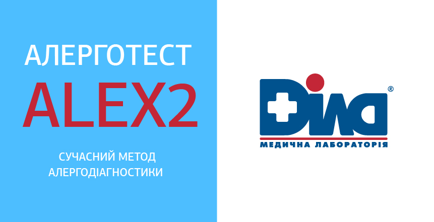 Фото - ДІЛА начала выполнение ALEX2