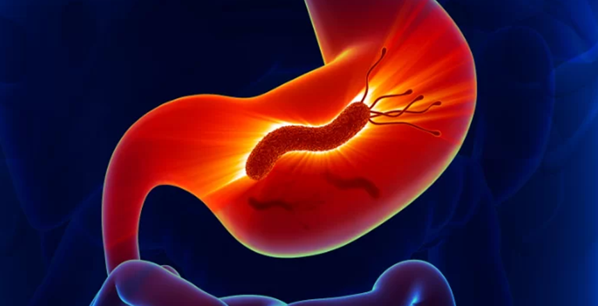 Фото - Клинический случай: роль лабораторных исследований в диагностике Helicobacter pylori-ассоциированного гастрита