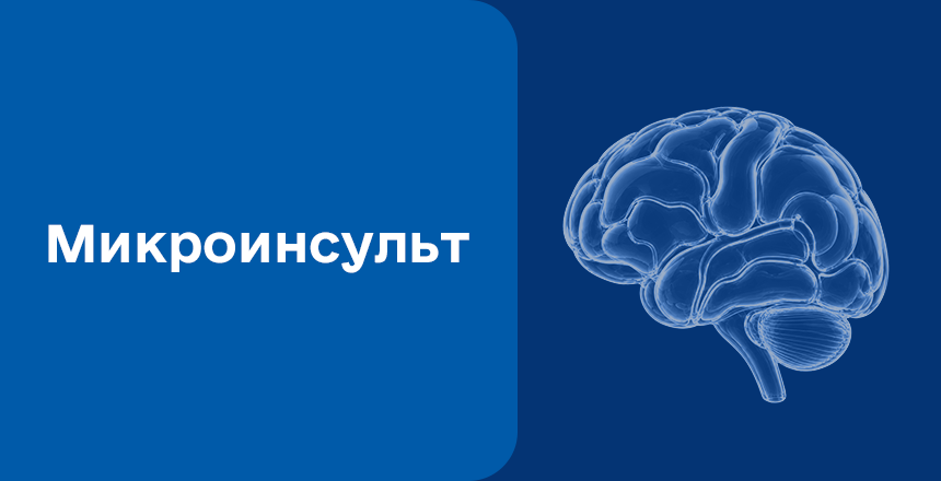 Фото - Микроинсульт: симптомы, причины и первая помощь
