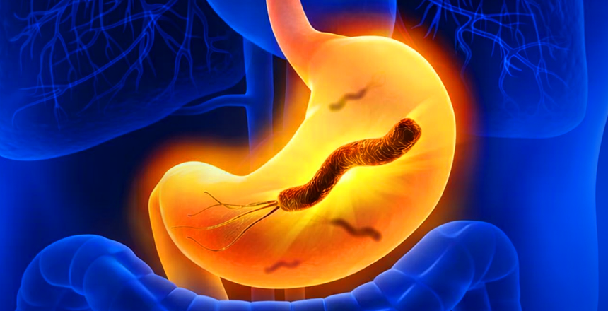 Фото - СУЧАСНІ ДІАГНОСТИЧНІ РІШЕННЯ В ДІЛА: Хелікобактеріоз, Helicobacter pylori антиген в калі, моноклональні антитіла кількісне визначення